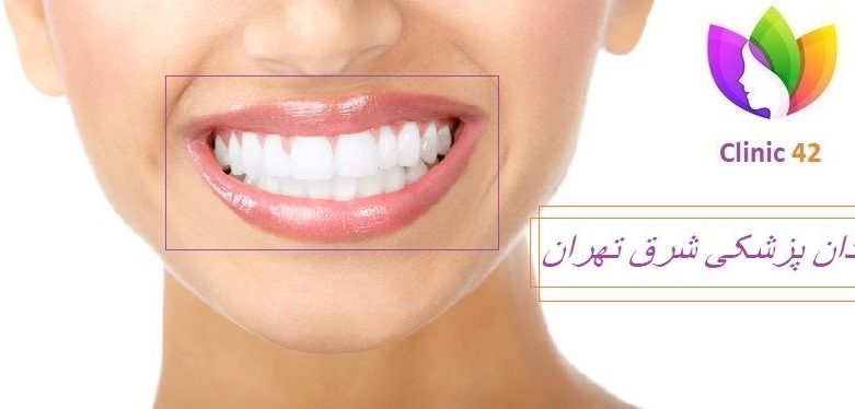 مطب دندانپزشکی در شرق تهران دندانپزشکی زیبایی
