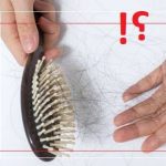علت کرکی شدن موی جلوی سر چیست ؟